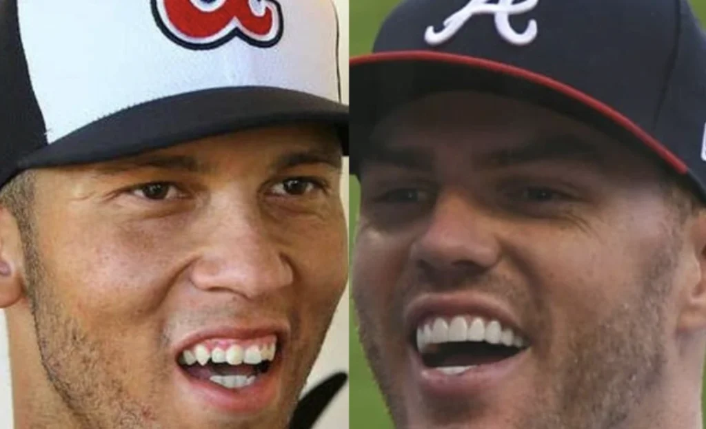 Freddie Freeman’s Teeth Transformation: Before and After