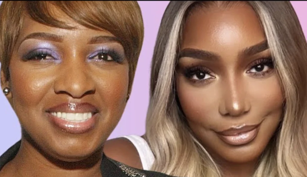 NeNe Leakes: Before and After Plastic Surgery