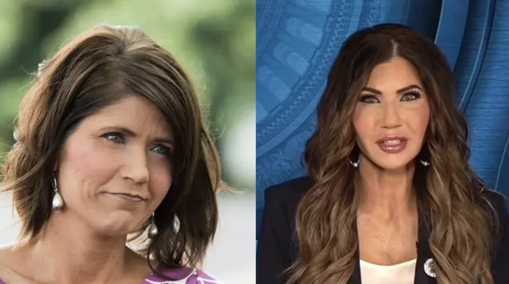 Kristi Noem Before and After